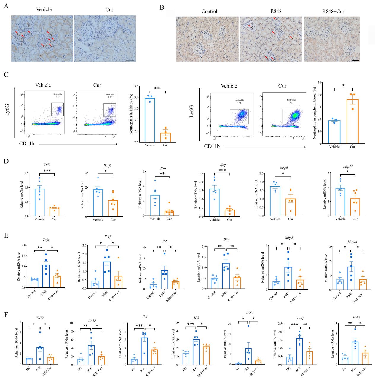 Curcumin attenuates lupus nephritis by inhibit…